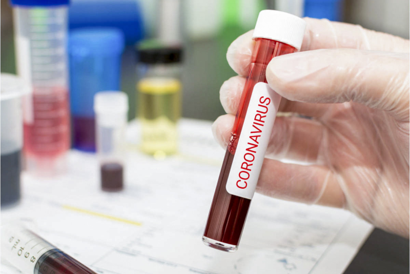 Koronavirusa yoluxmanın artmasının səbəbləri açıqlanıb