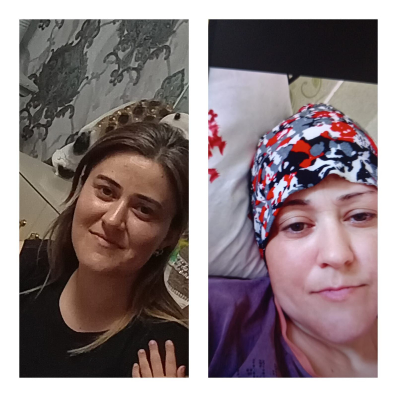 Ağır xərçəng xəstəliyindən əziyyət çəkən xanıma gəlin dəstək olaq